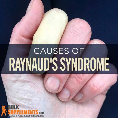 white feet|Raynaud’s Syndrome: Symptoms, Causes & Treatment